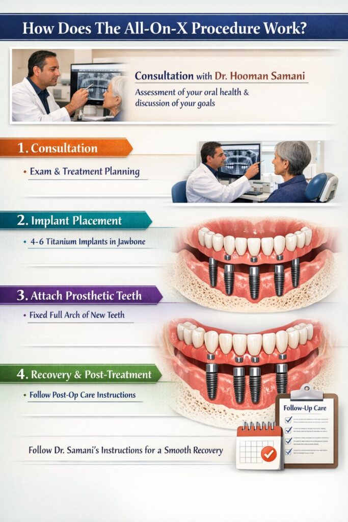 How Does The All-On-X Procedure Work
