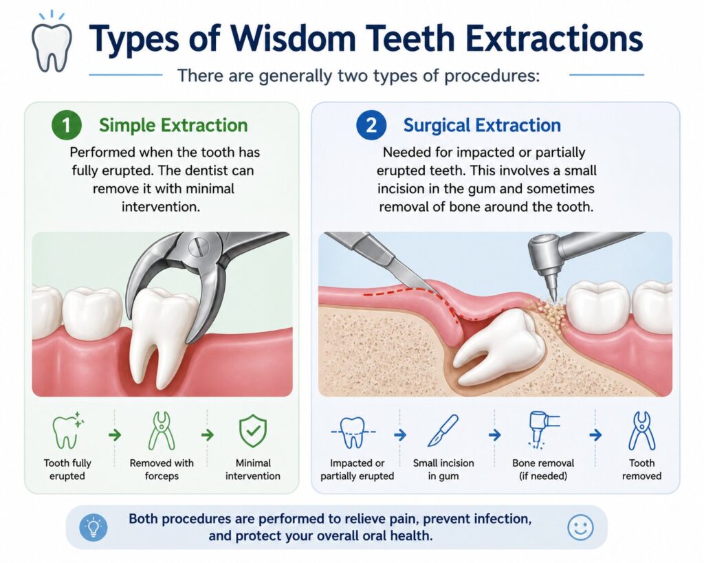 Types of Wisdom Teeth Extractions